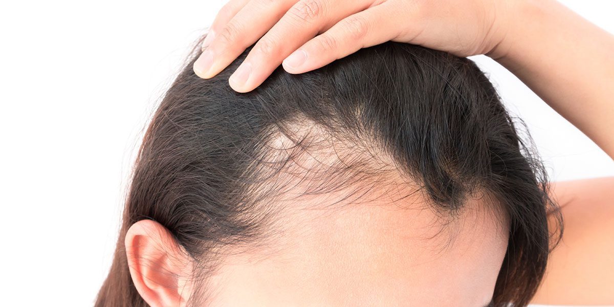 How To Reduce Hair Loss In Men Prevent Hair Loss By Natural Way
